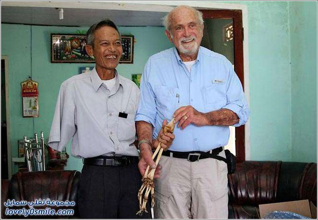 فيتنامي يستعيد ذراعه المبتورة بعد 47 عاماً
